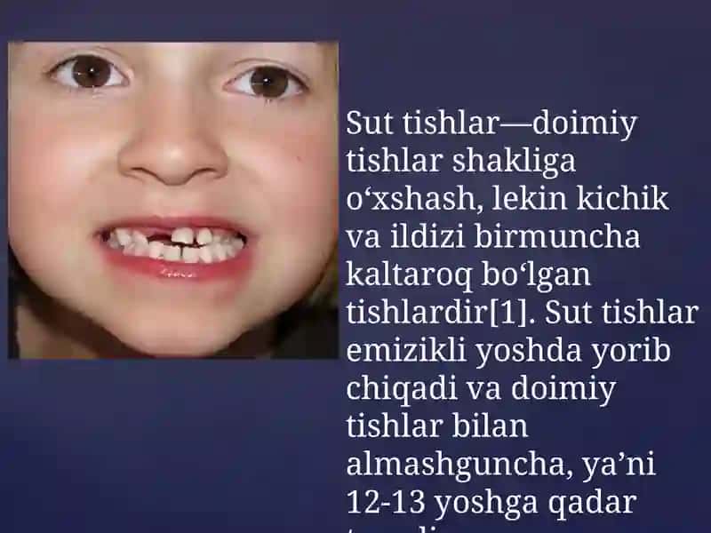 Suttishlarinianatomiyasi.Chiqishvaqti.Doimiytishdanfarqi.Tish-jag`segmentlari,burunbo`shlig`i,yuqorijag`bo`shlig`i,prikuslarvaanomaliyalari 2