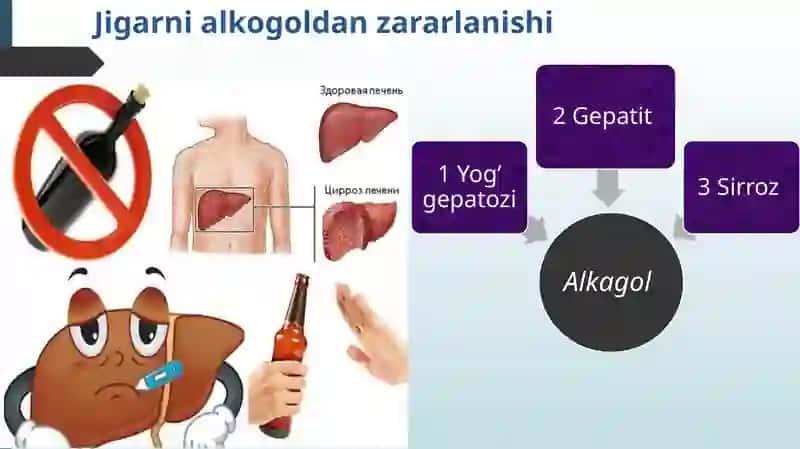 Jigarning alka gol dan zararlanishi, Jigarsir rozi va Jigar o’smalar 2