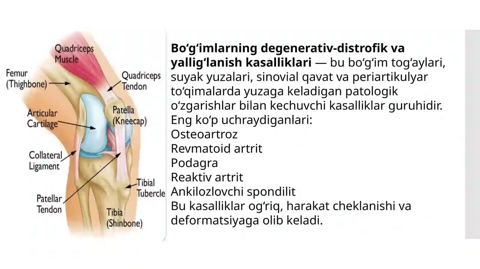 Boʻgʻimlarni degenerativ distrofik yalligʻlanish kasalliklari. 2