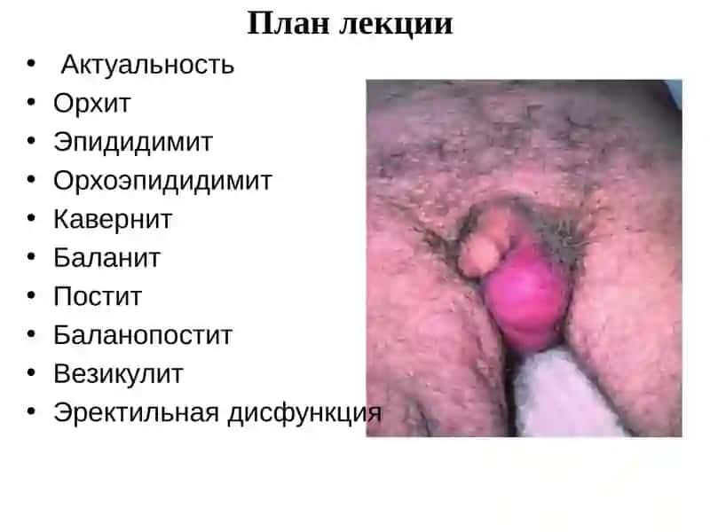 Актуальность 2