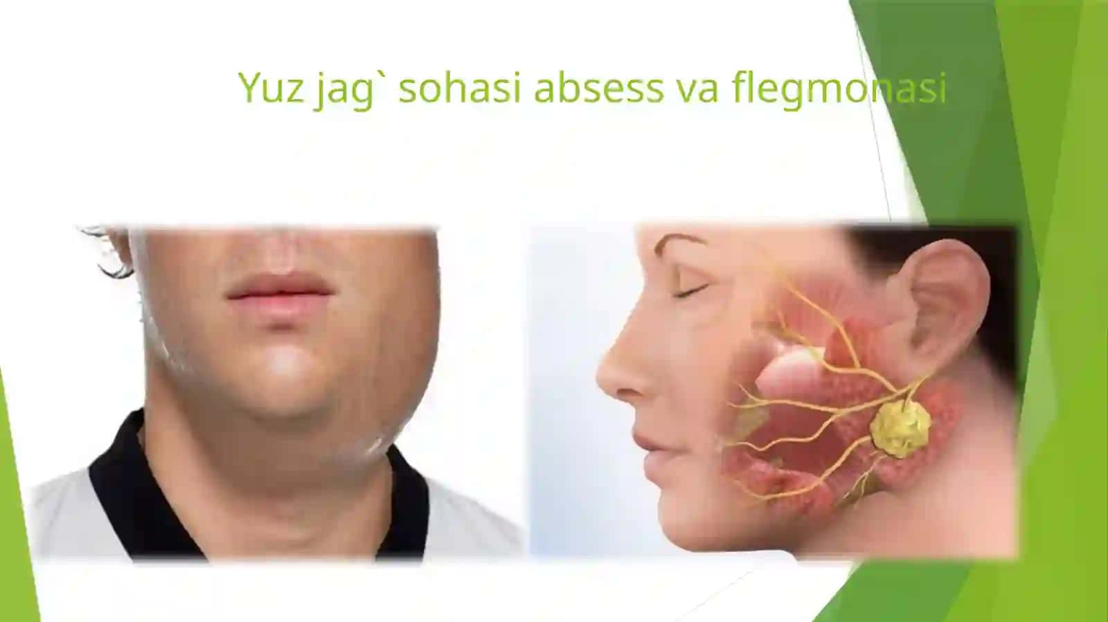 Yuz-jag' kasalliklari va jaroaxatlari 2