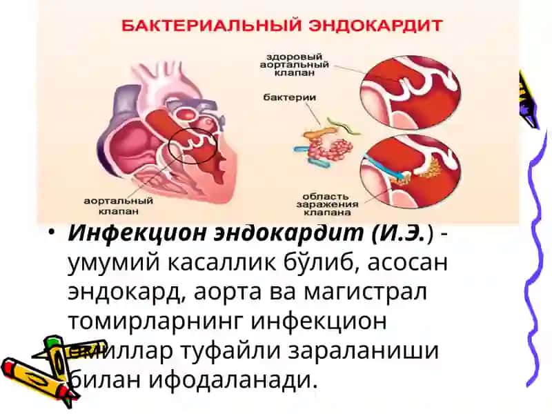 Бактериал септик эндокардит 2