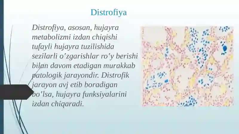Yog' va uglevodli distrofiyalar 2