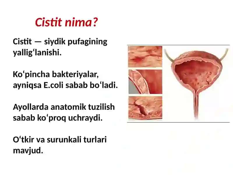 CISTIT 2