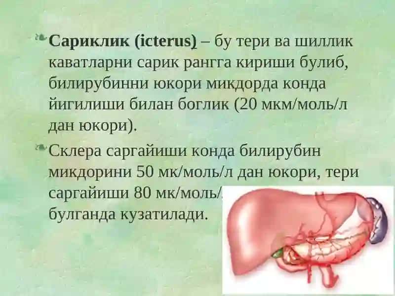 Sariqlikning qiyosiy tashxisoti 2