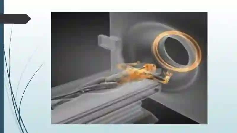 Nur tashxisi usullari 2