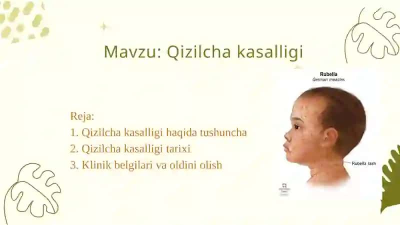 QIZILCHA KASALLIGI. 2