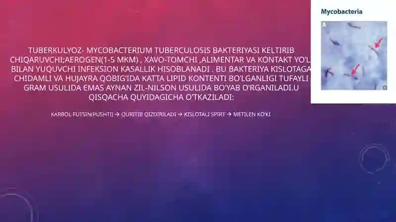 BIRLAMCHI TUBERKULYOZ 2
