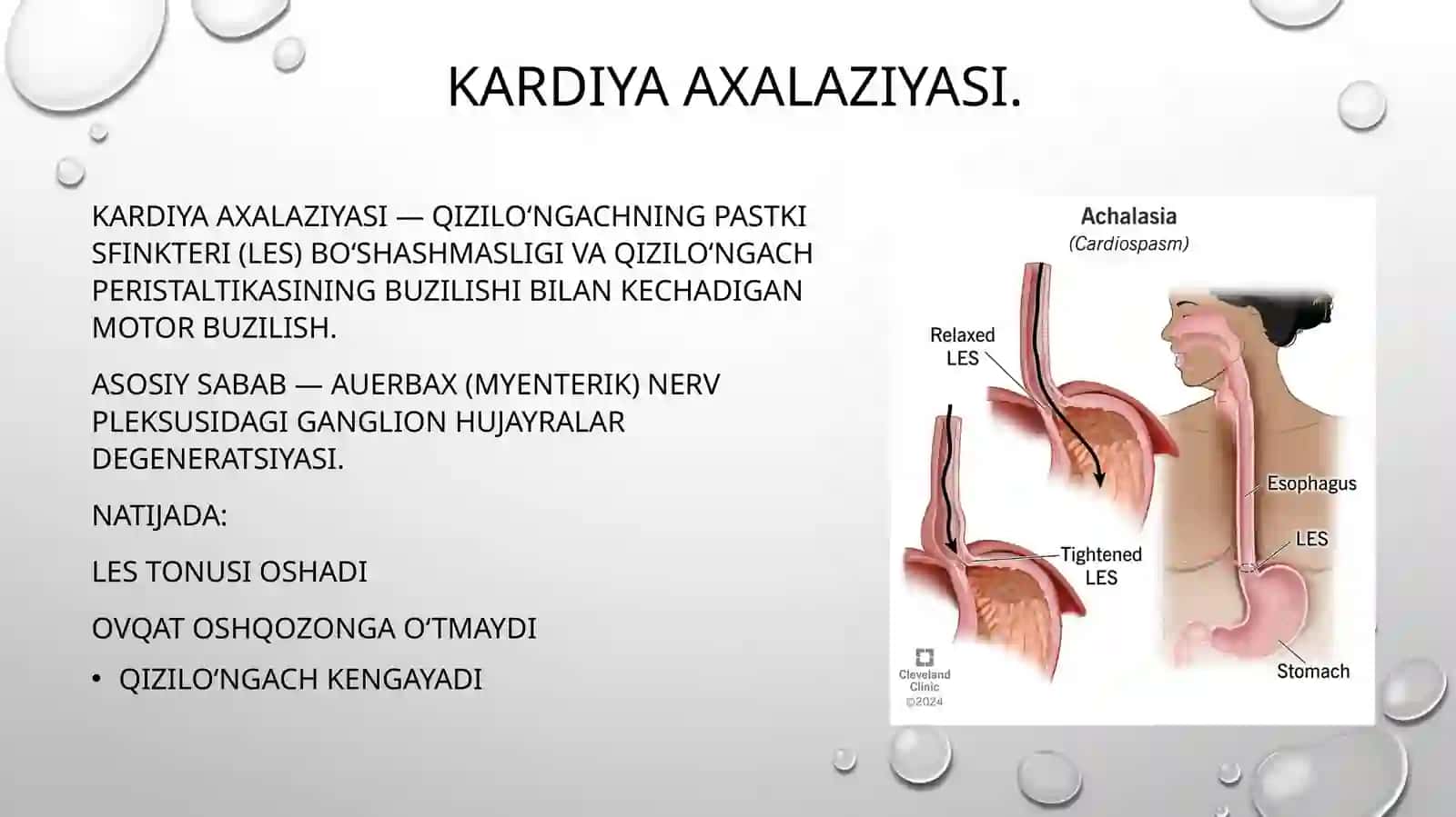 Kardiya axalaziyasi.Gastroezofageal refluks kasalligi.Barret qizilo’ngachi. Oshqozon va o’n ikki barmoqli ichak yara kasalligi asoratlari, diagnostikasi 2