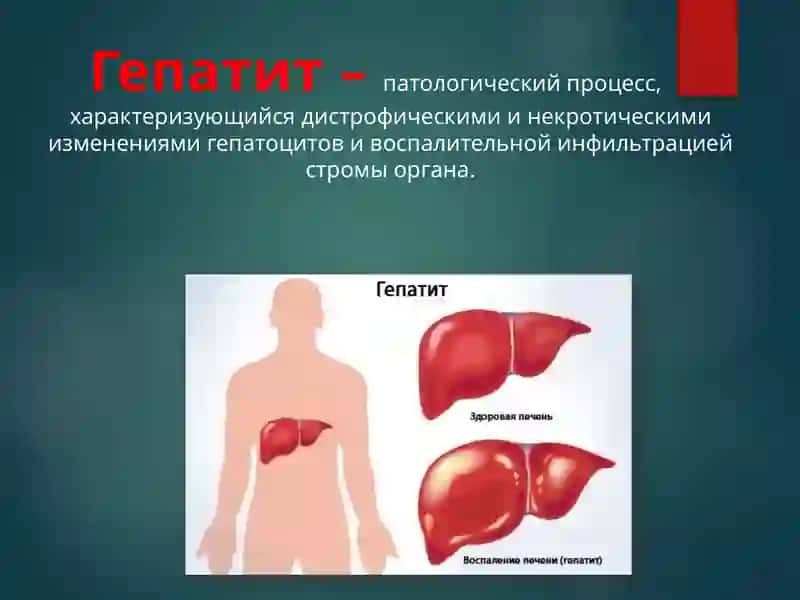 Гепатит 2