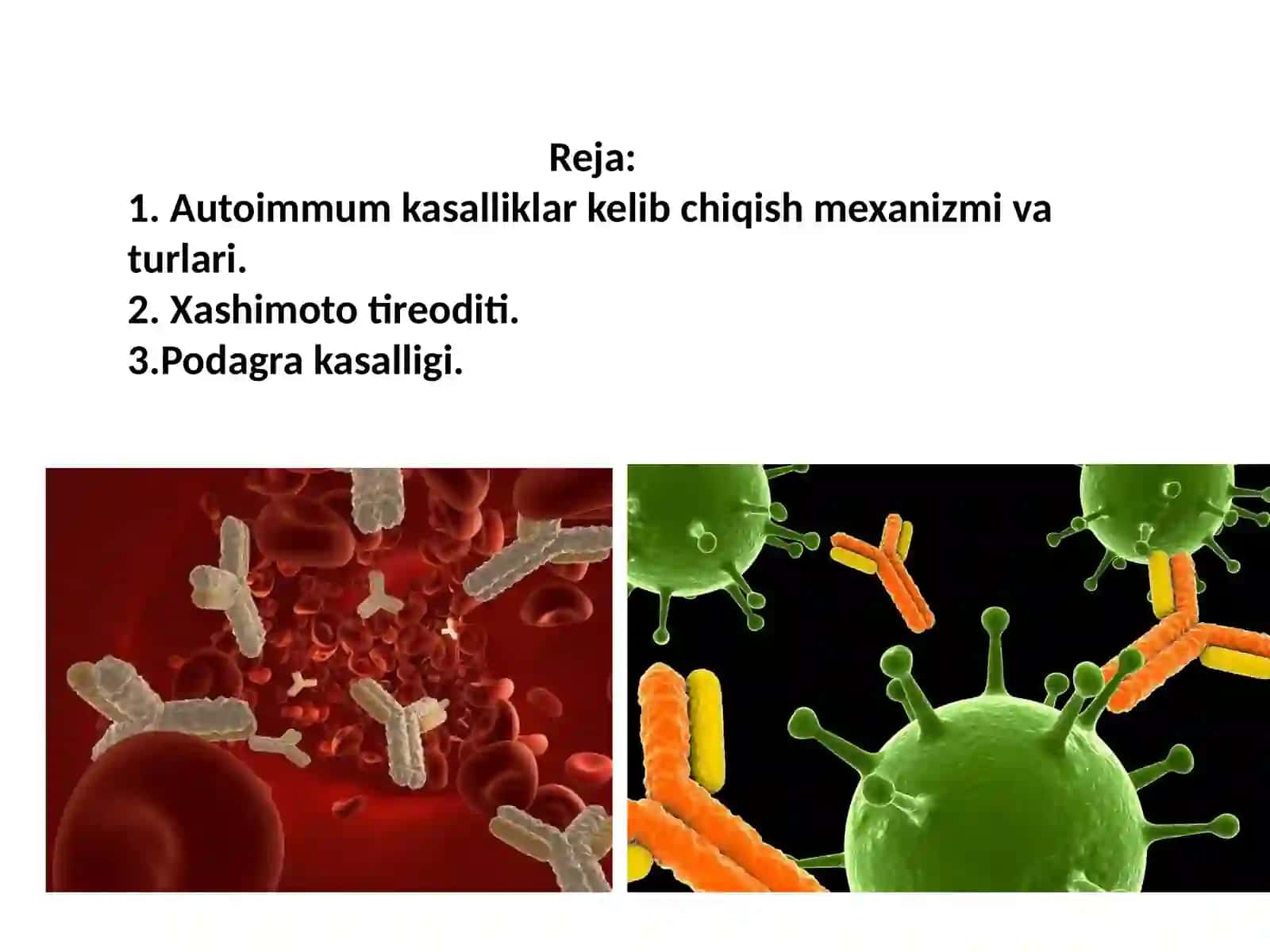 Autoimmun kasalliklar 2