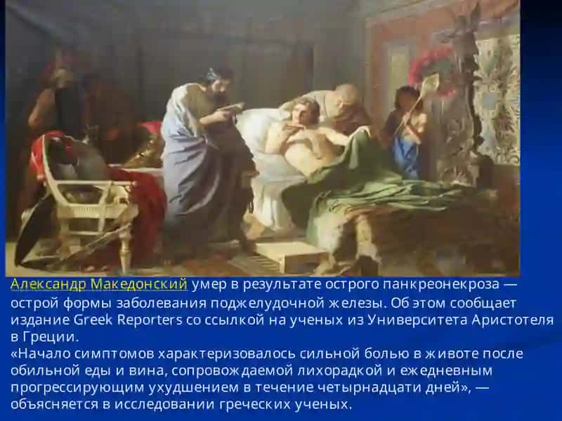 ОСТРЫЙ ПАНКРЕАТИТ 2