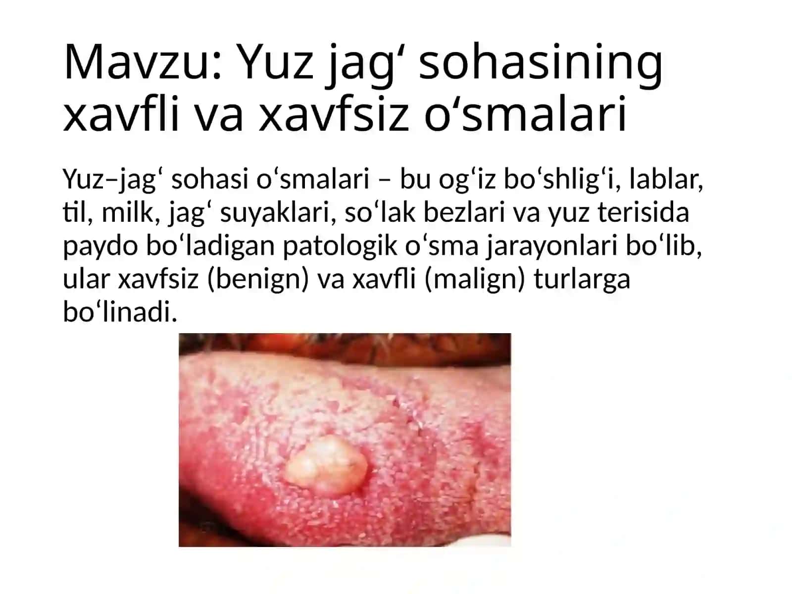 Yuz jagʻ sohasining xavfli va xavfsiz oʻsmalari 2