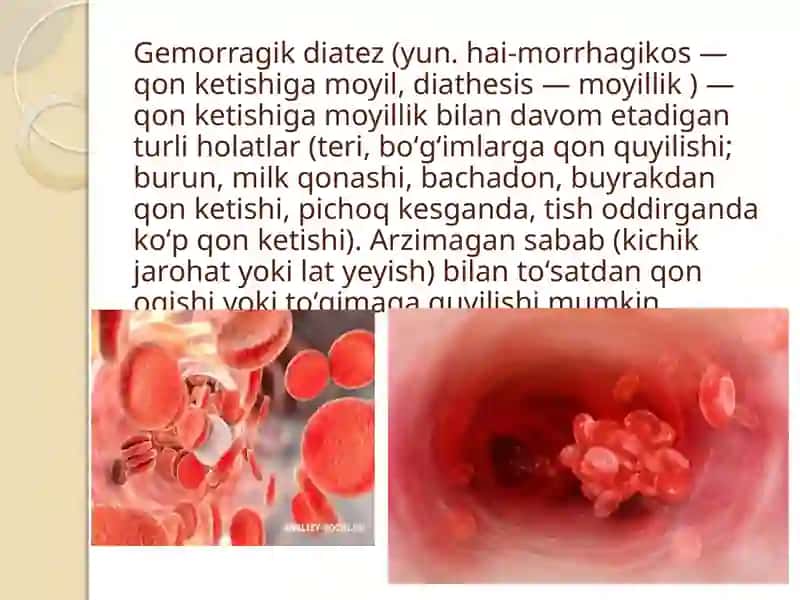 Tibbiyot. Gemorragik diatezlar 2
