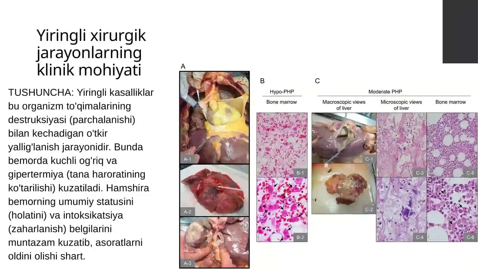yiringli xirurgik kasalliklar bilan og'rigan bemorlarni parvarishi va xususiyatlari 2