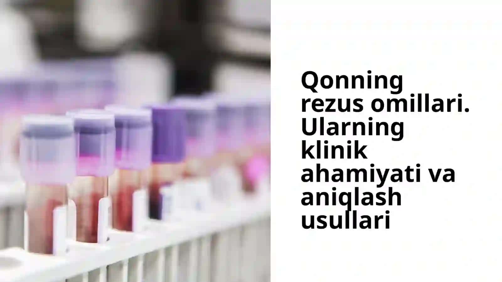 Rezus faktor 2