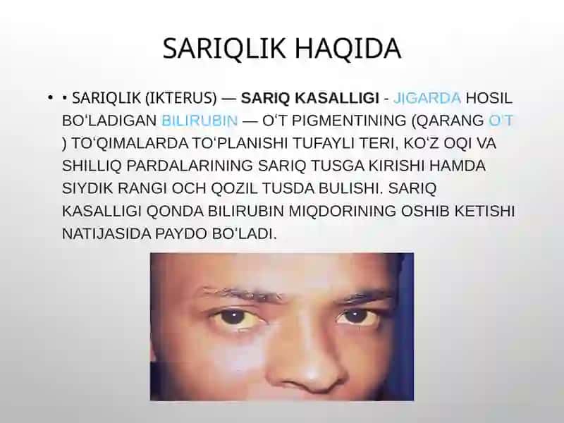 Sariqlikning biokimyoviy jihatdan differensial tashxisi 2
