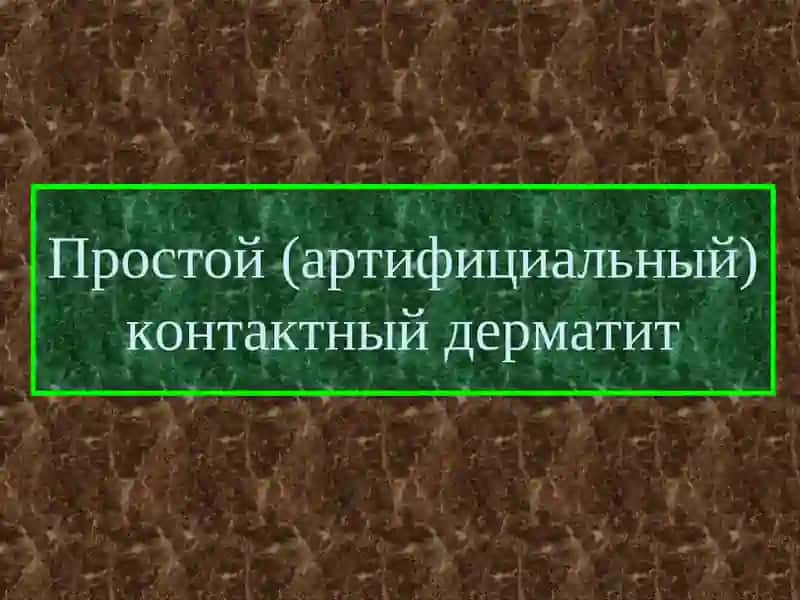 Классификация дерматитов 2