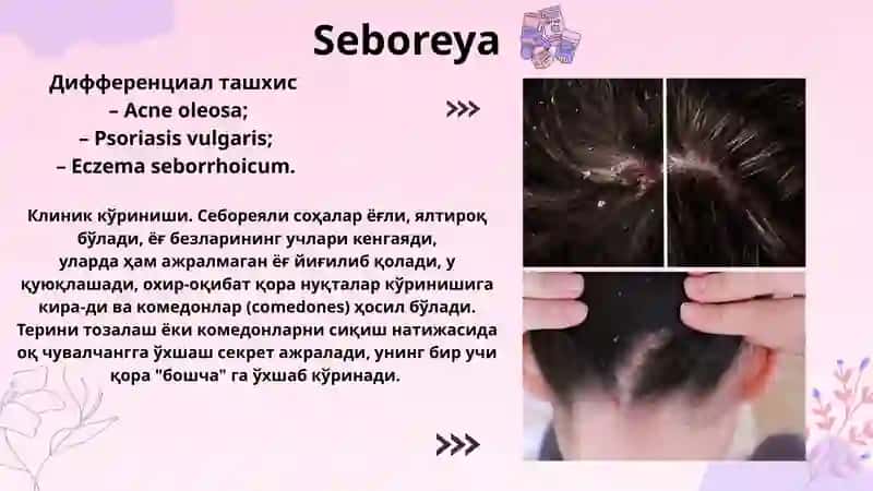 Seboreya 2