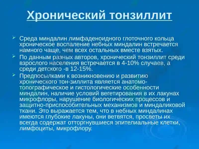 Хронический тонзиллит 2
