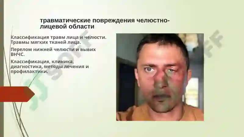 КАФЕДРА ЗАБОЛЕВАНИЯ И ТРАВМЫ 2