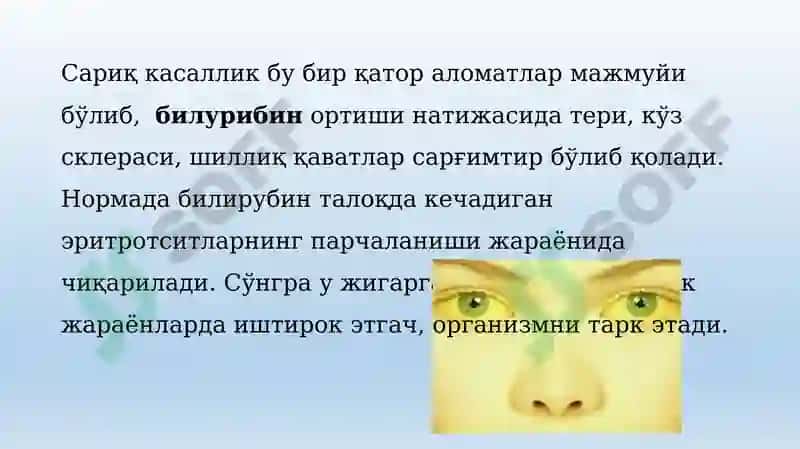 Сариклик синдроми 2