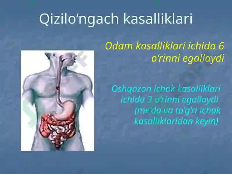 Bolalarda qizilo’ngach kuyishi va yot jismlari. Etiopatogenez, klinika, diagnostika va davolash usullari 2