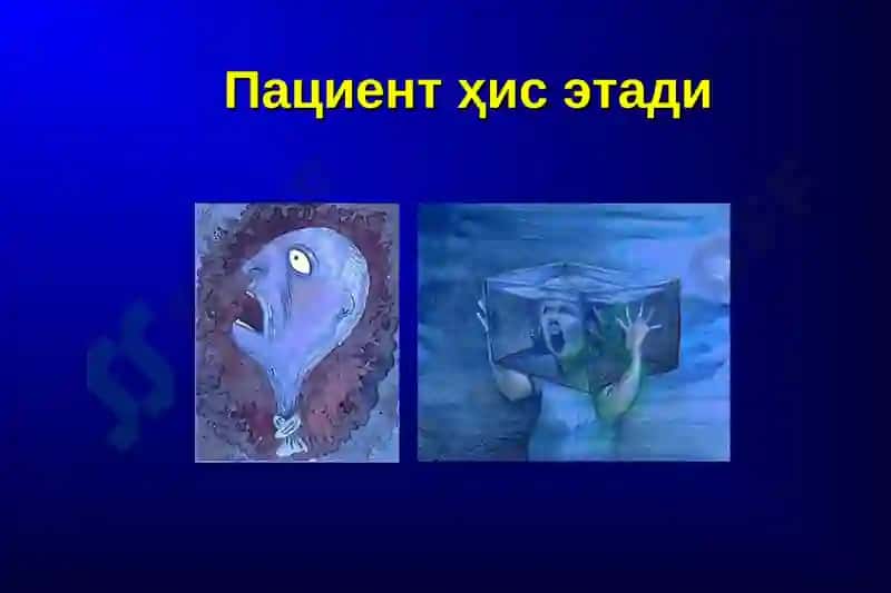Бронхиал астма 2