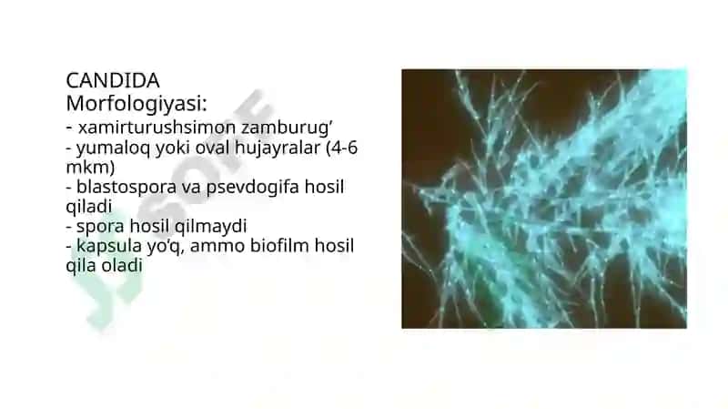 Zamburug'lar keltirib chiqaruvchi kasalliklar qo'zg'atuvchilari, patogenezi, laboratoriya tashxisi. 2