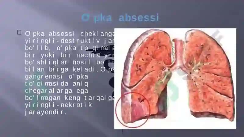 O’PKA ABSESSI VA GANGRENASI ETIOLOGIYASI 2