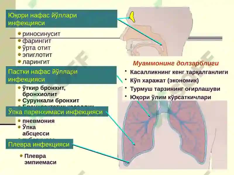ЎТКИР ПНЕВМОНИЯ 2