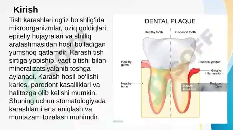 Tish karashlari. Tish karashlarini tozalash usullari, asbob-uskunalar. Parodont to’qimasini patologiyasi bor bemorlarni tekshirish usullari (asosiy va qo’shimcha usullar). Parodont to’qimasini tuzilishi, funksiyasi. Parodont kasalliklarini tasnifi 2