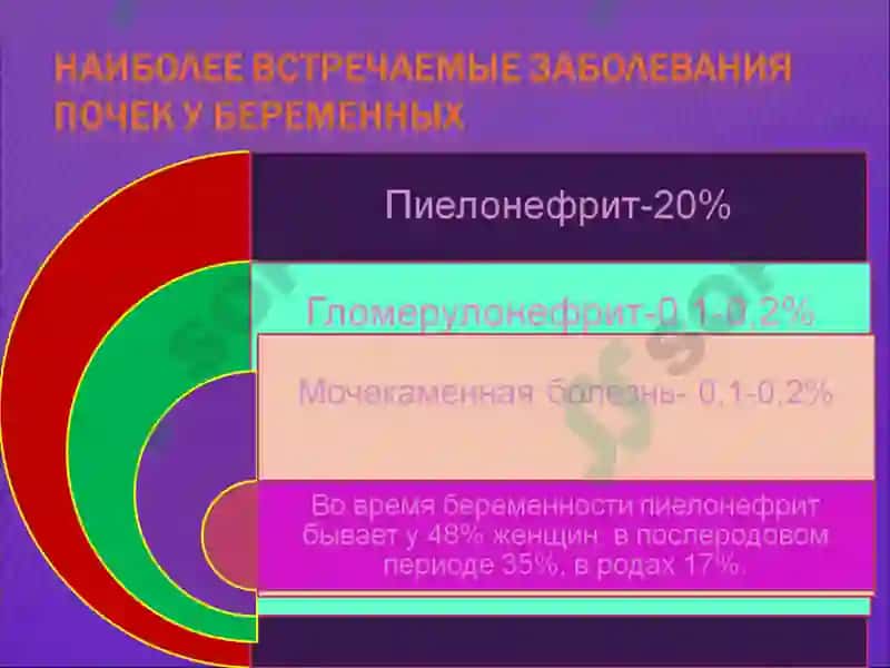 Бессимптомная бактериурия 2