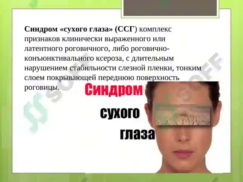 Синдром сухого глаза 2