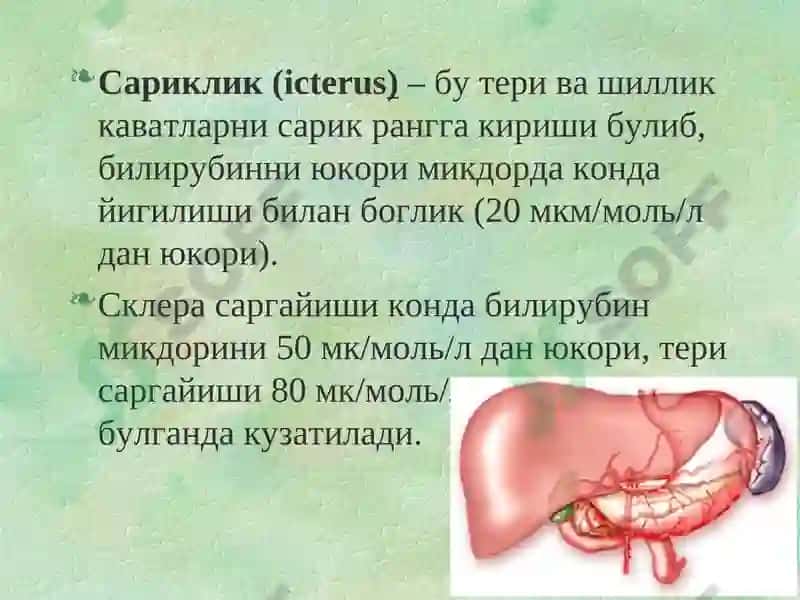 Сариқликнингқиёсий ташхисоти 2