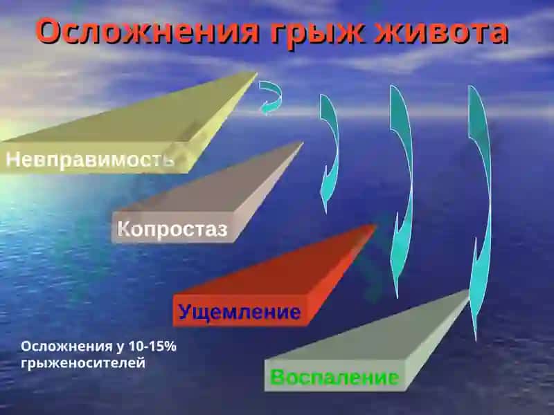 Осложнения грыж живота 2