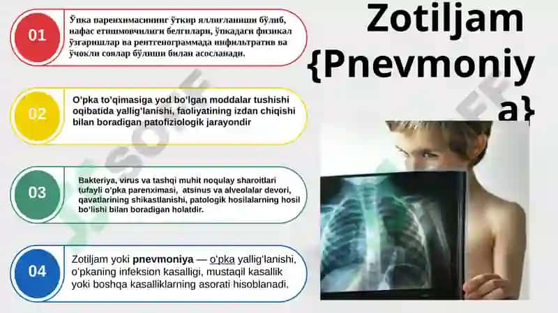 Zotiljam 2