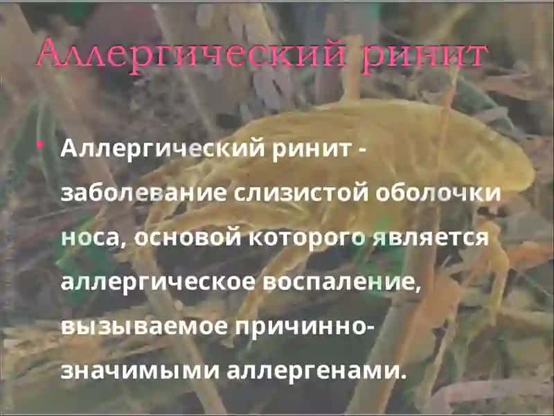 Аллергический ринит 2