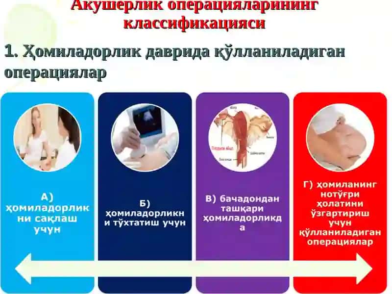 Tug’ruqni amalga oshiruvchi operastiyalar kesar kesish akusherlik qisqichlari vakuum ekstrakstiya 25 2