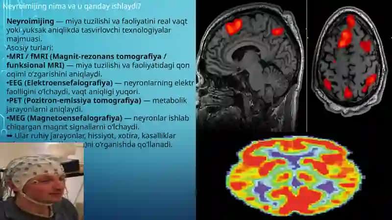Neyroimijning(miyatasvirlash) texnologiyalarini ishlab chiqish va u'lardan foydalanishda yuzaga keladigan asosiy axloqiy muammolar 2