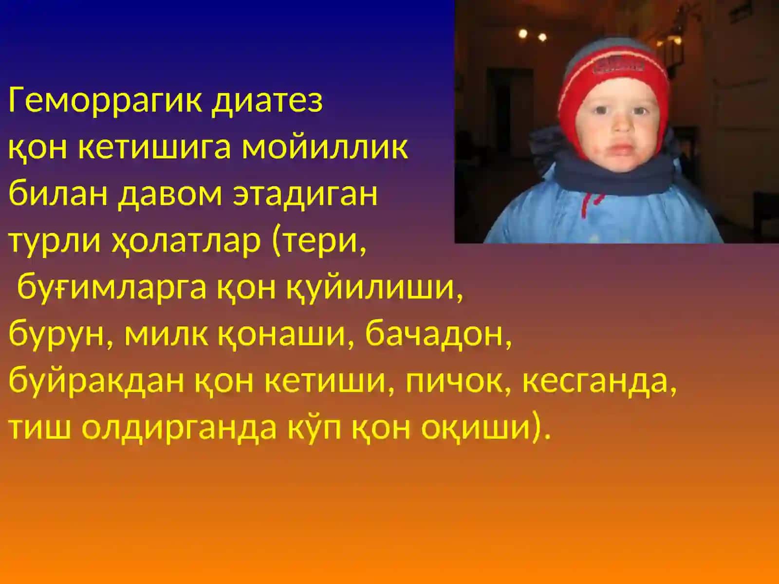 Геморрагик диатезлар 2