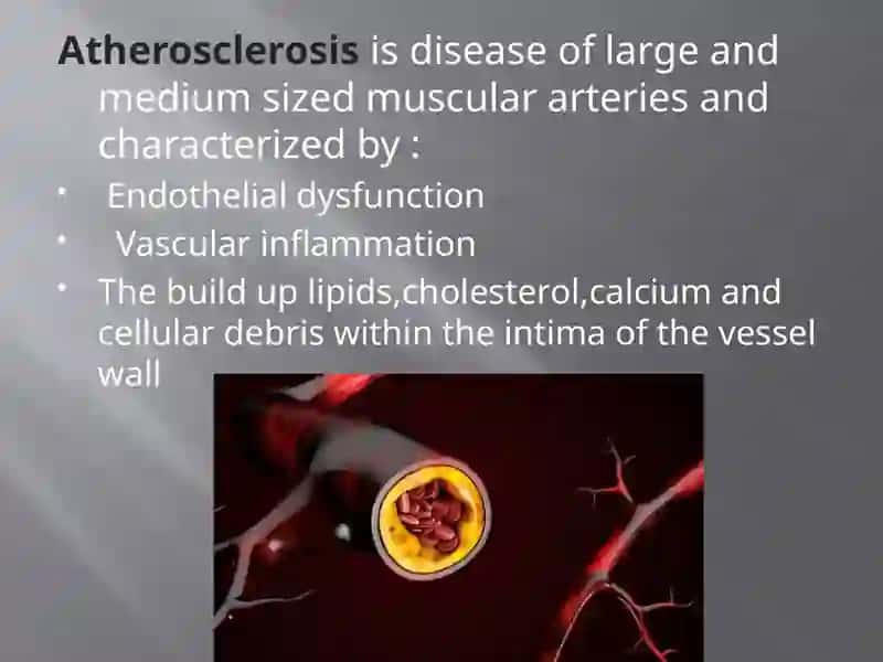 Atherosclerosis 2