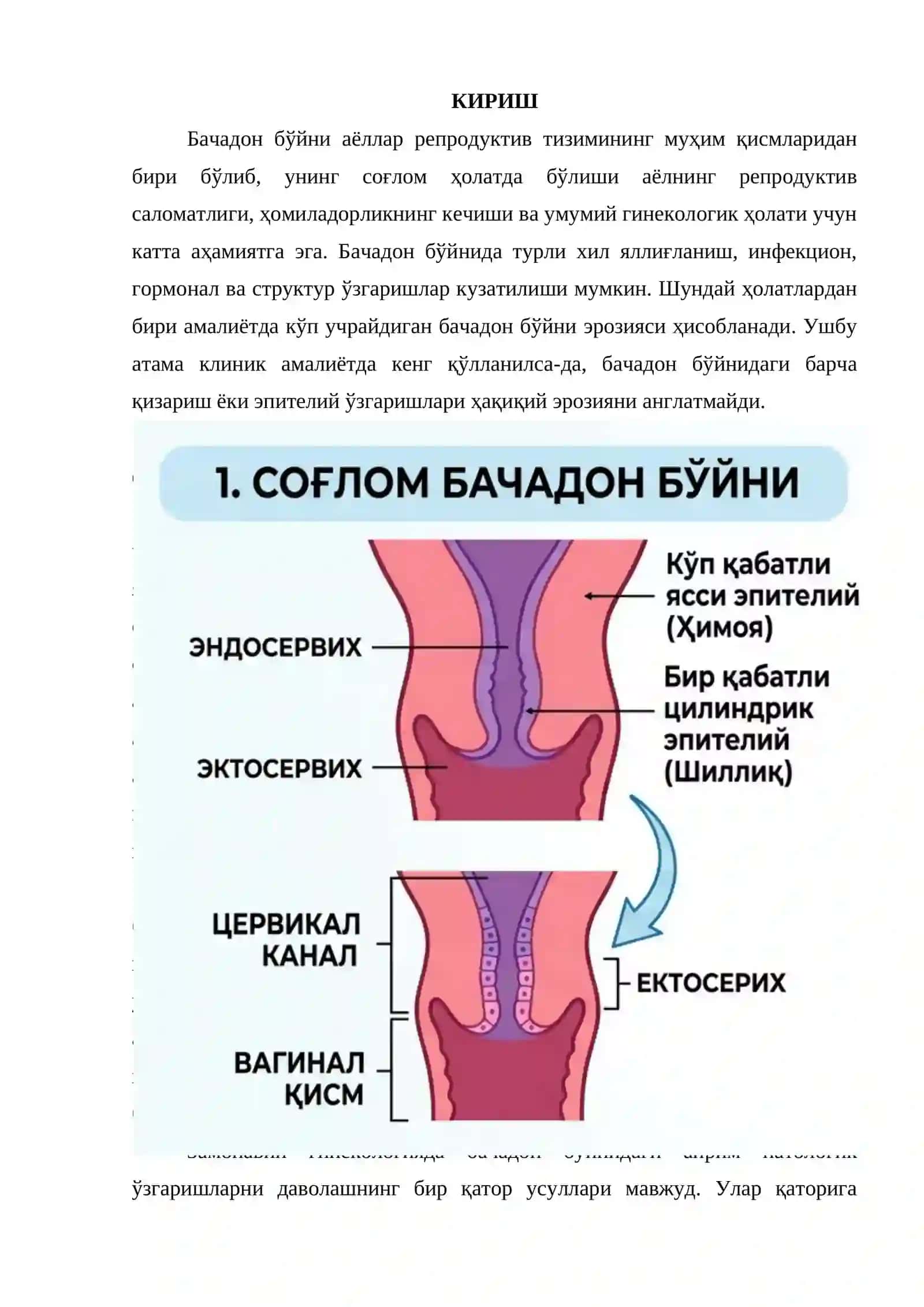 Бачадон бўйни эрозияси: келиб чиқиш сабаблари, клиник белгилари ва лазер усулида даволаш 2