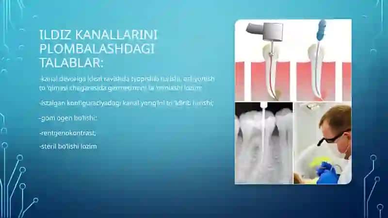 Ildiz kanallarini plombalash usullari 2