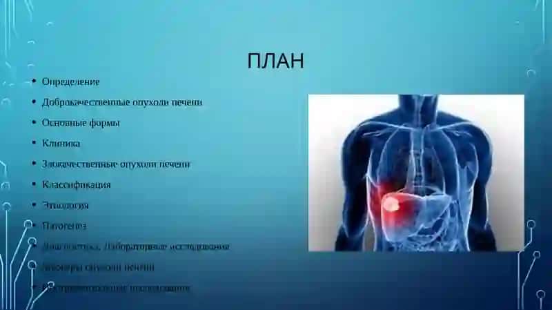 Опухоли печени. Клинические особенности. Серологические маркеры 2