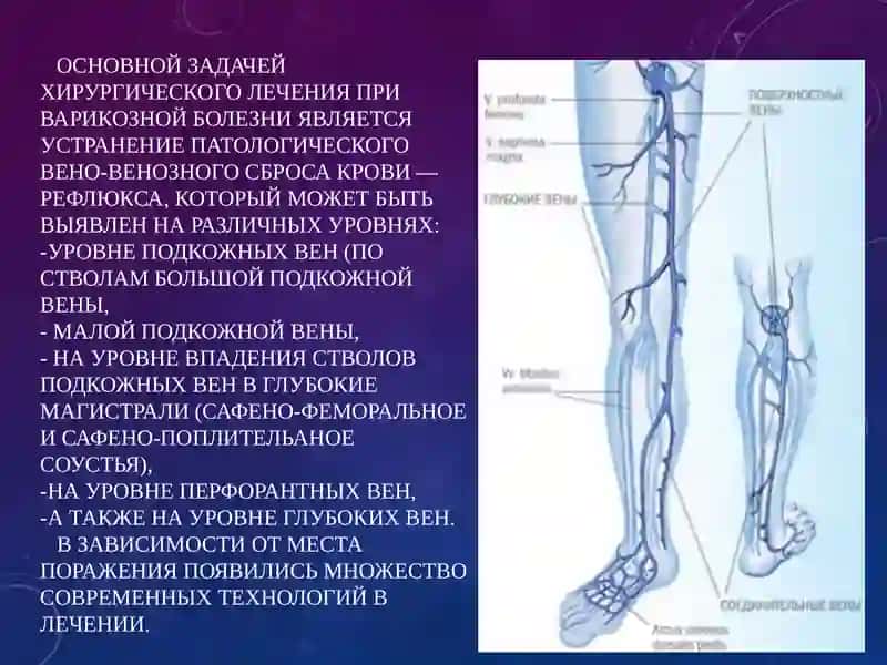современнаясклеротерапия 2