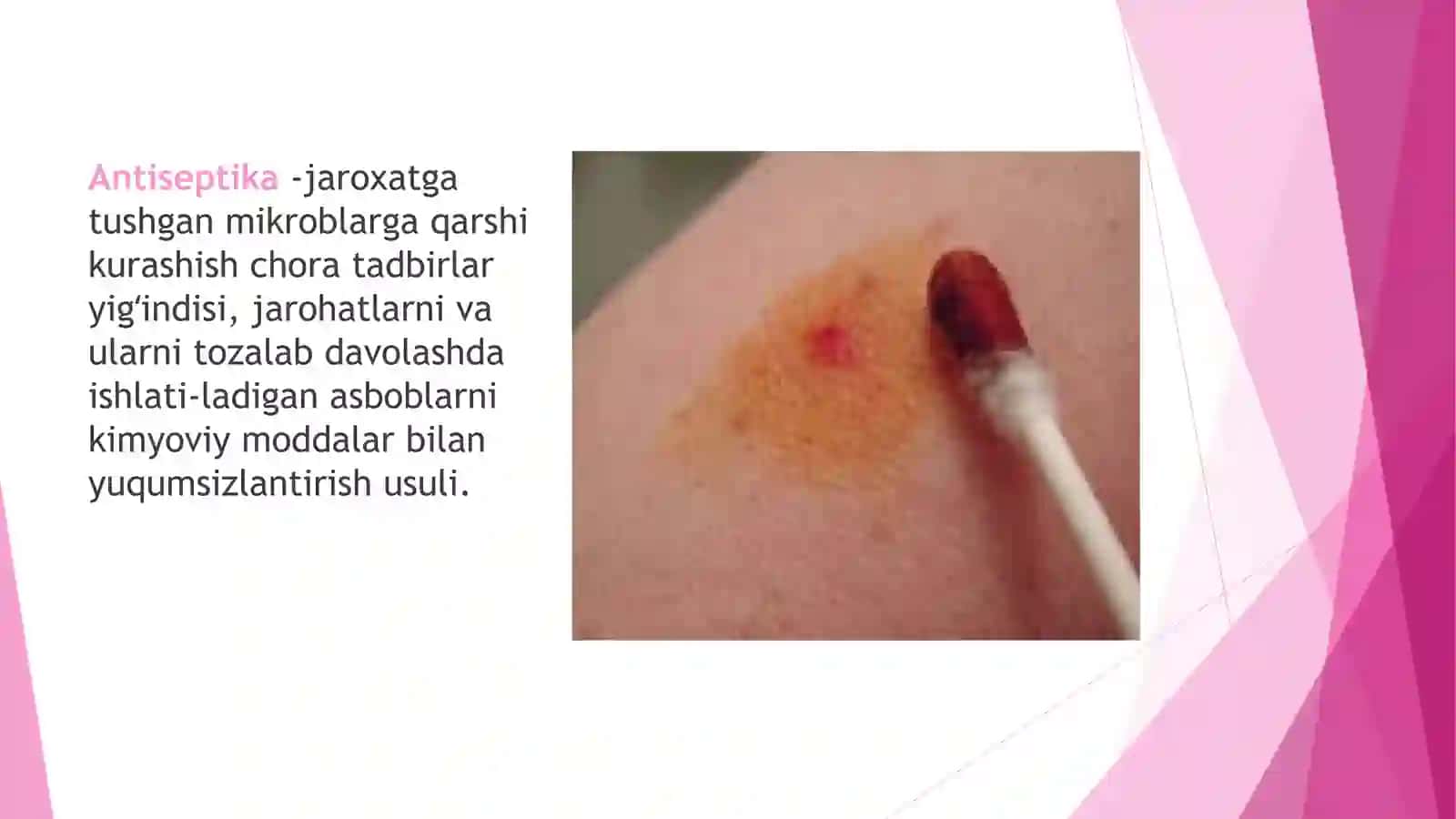 ANTISEPTIKA.FIZIK, KIMYOVIY, MEXANIK, BIOLOGIK VA ARALASH ANTISEPTIKA TURLARI 2