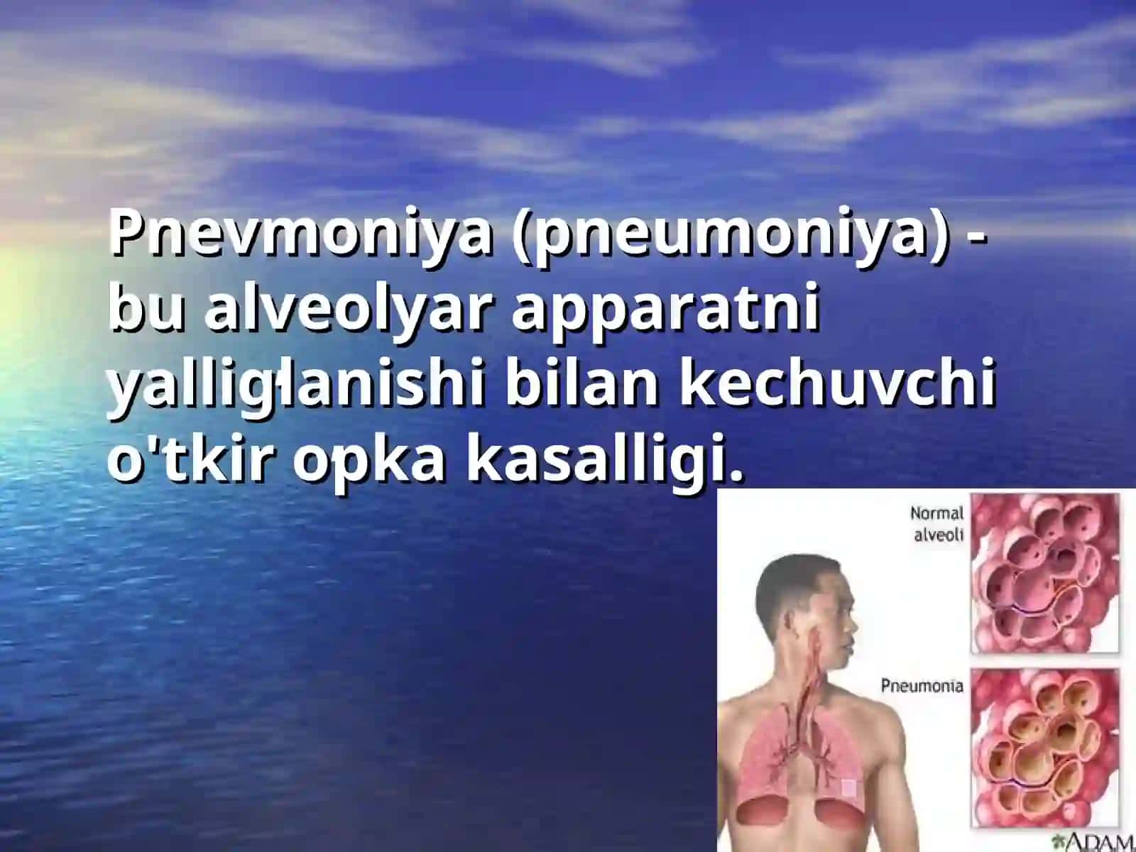 Pnevmoniya (Pneumoniya) 2