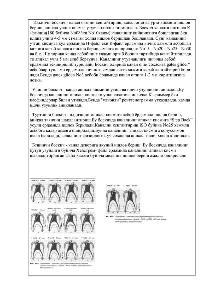 Илдиз каналини коранал-апикал кенгайтириш усуллари 2