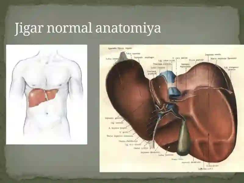 Jigardiffuz kasalliklarining ultraşonografik diagnostikasi 2